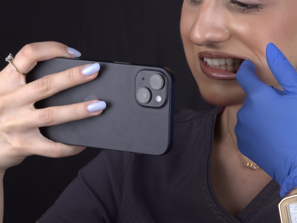 Photo of teeth - White Clinic Belgrade Close-up of a person holding a smartphone with two rear cameras visible, while a gloved hand touches their lips for a close-up selfie or demonstration.