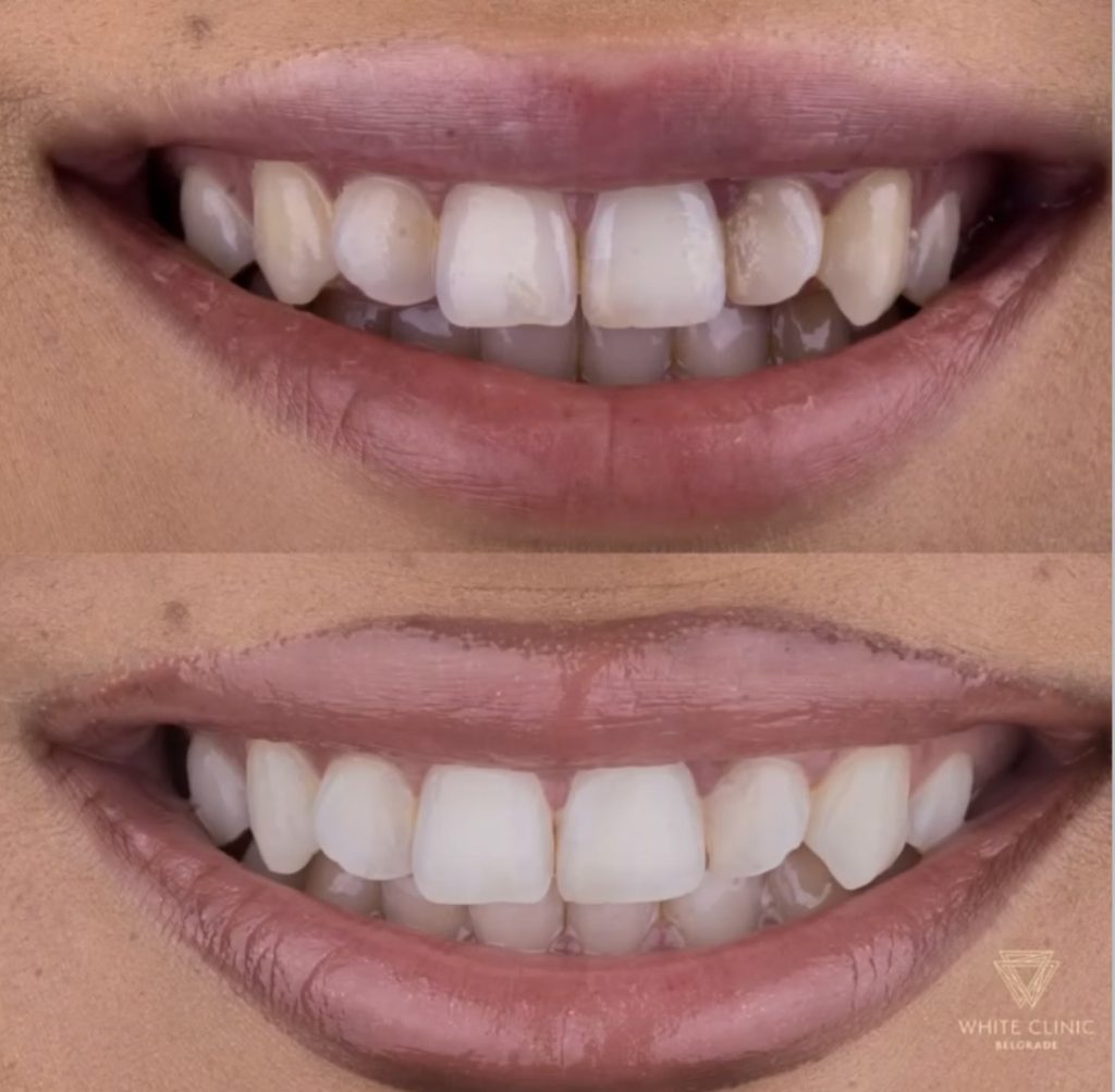 Screenshot - White Clinic Belgrade